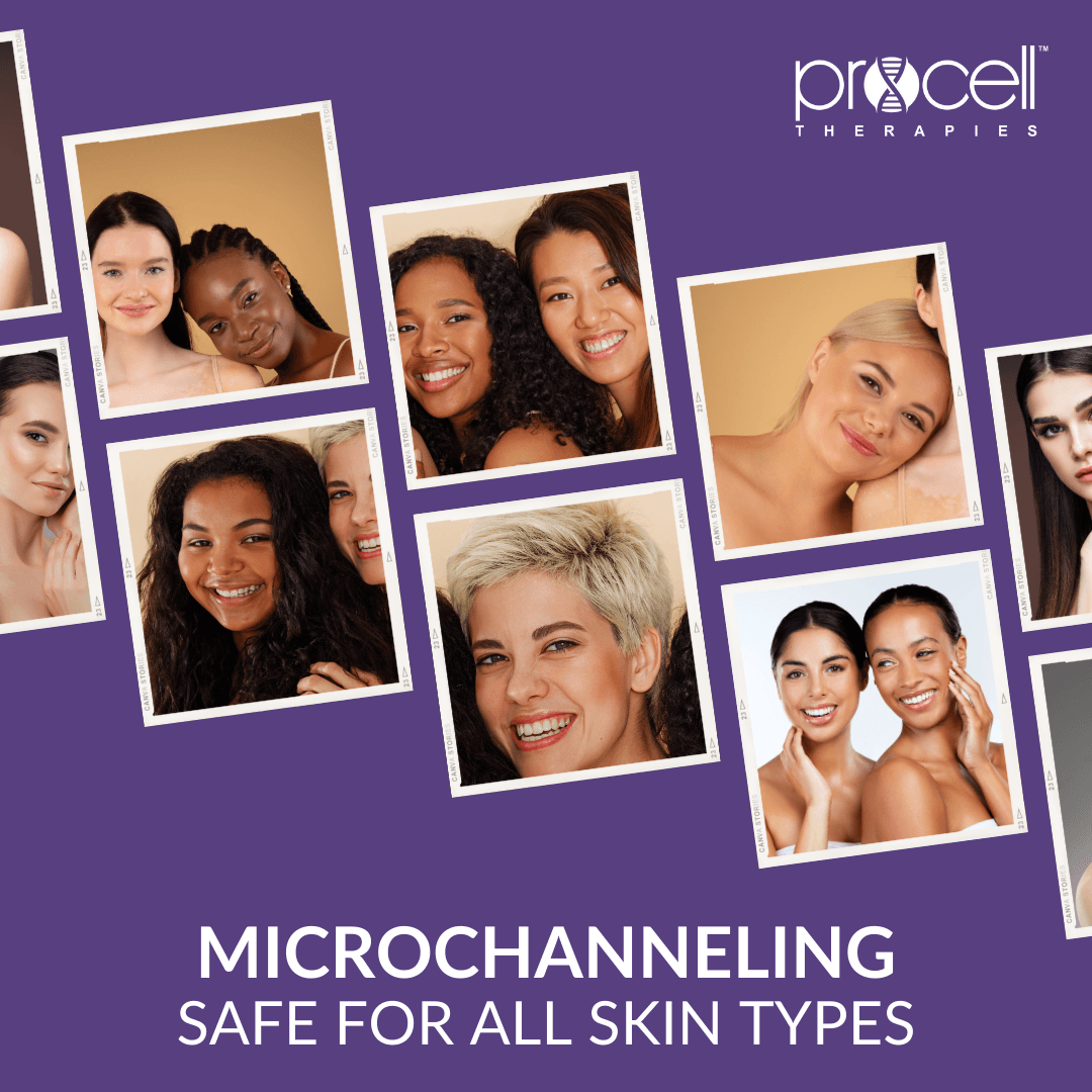 Procell Microchanneling Full Protocol